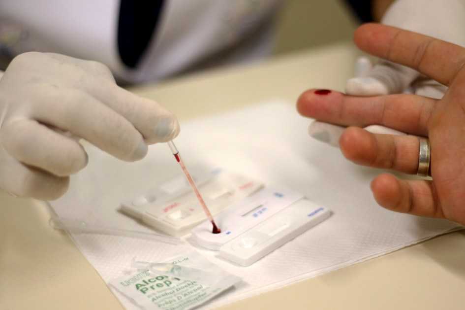 HIV