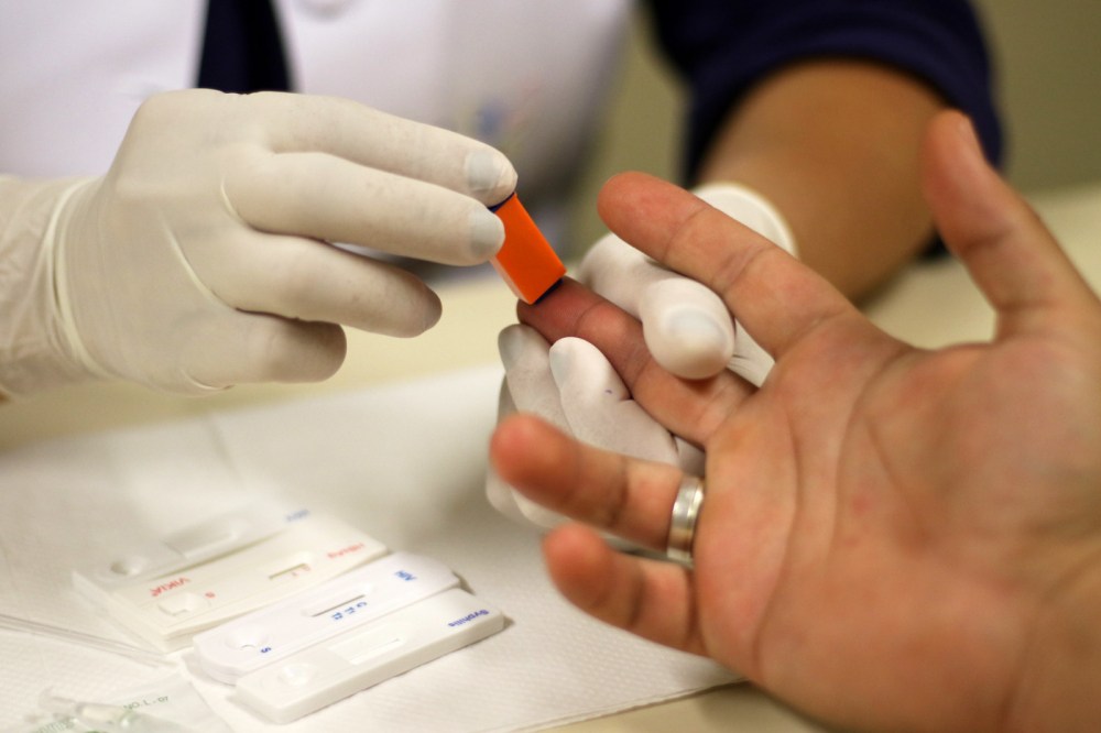 Brasil atinge 1 milhão de pacientes com HIV em tratamento médico