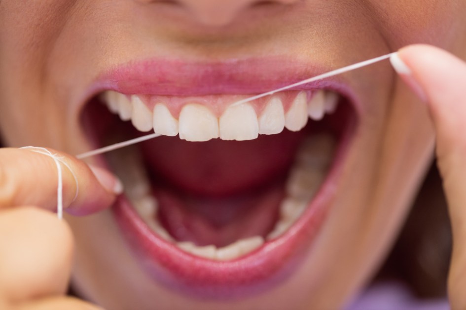 Fio dental