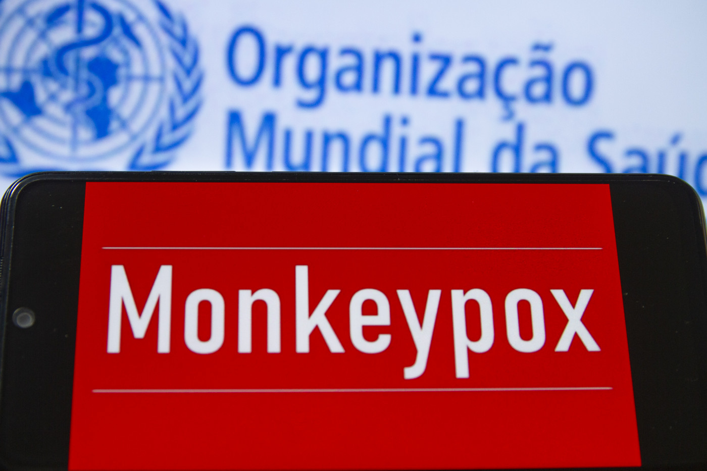 Estado de São Paulo confirma primeiro caso da nova cepa do vírus Mpox