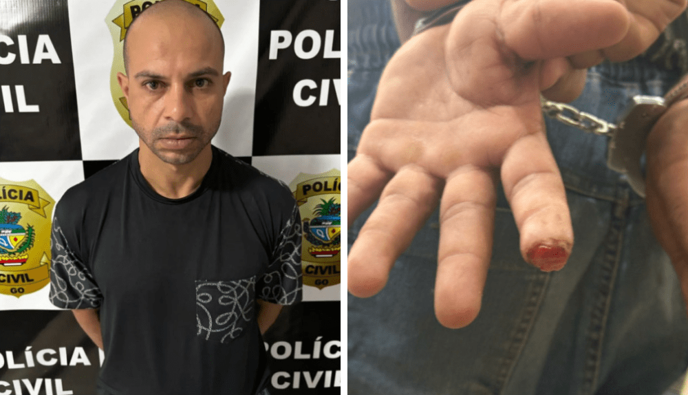 Estuprador em série: lutador é identificado após ter parte do dedo arrancado por vítima