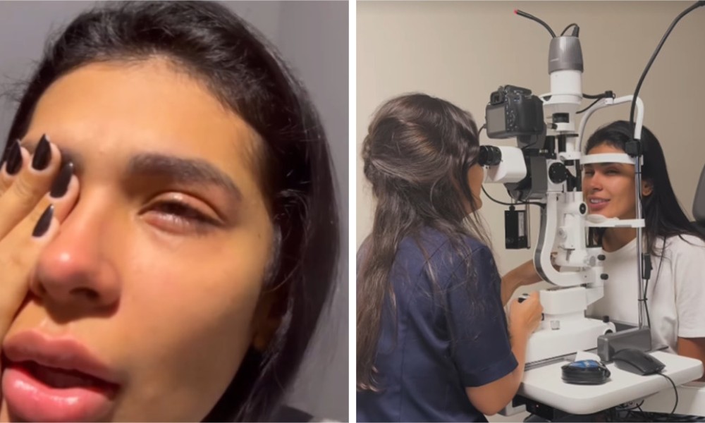 À esquerda, Pocah mostra como ficou olho esquerdo após acidente; à direita, foto da cantora na oftamologista