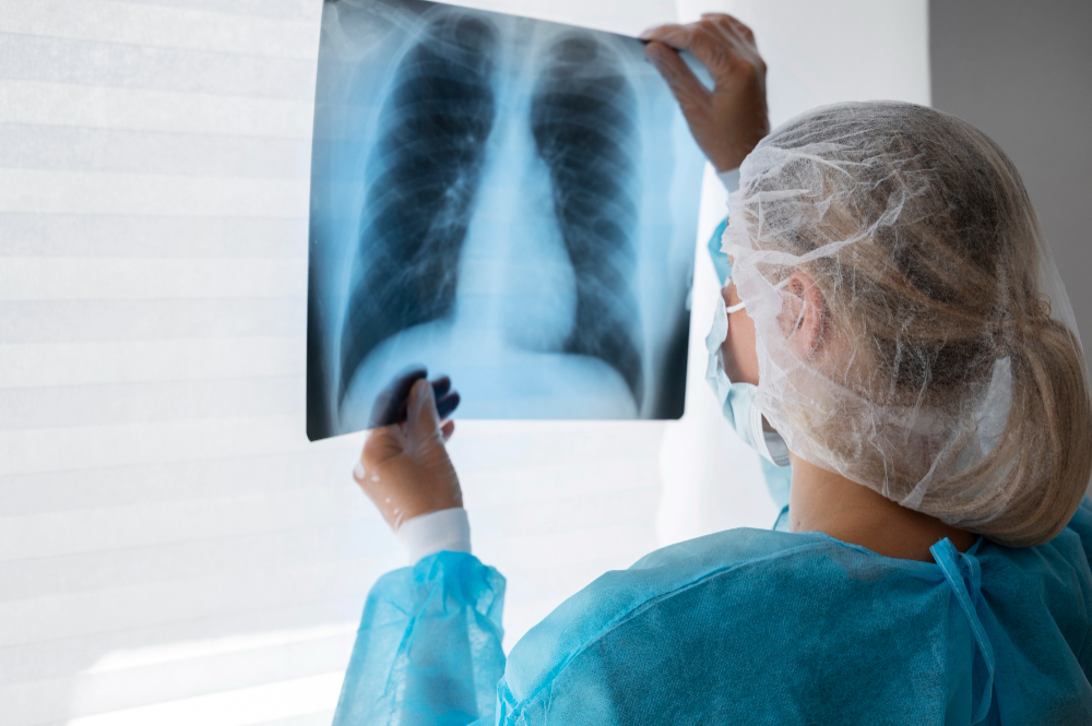 O olhar invisível da patologia pulmonar no combate ao câncer de pulmão