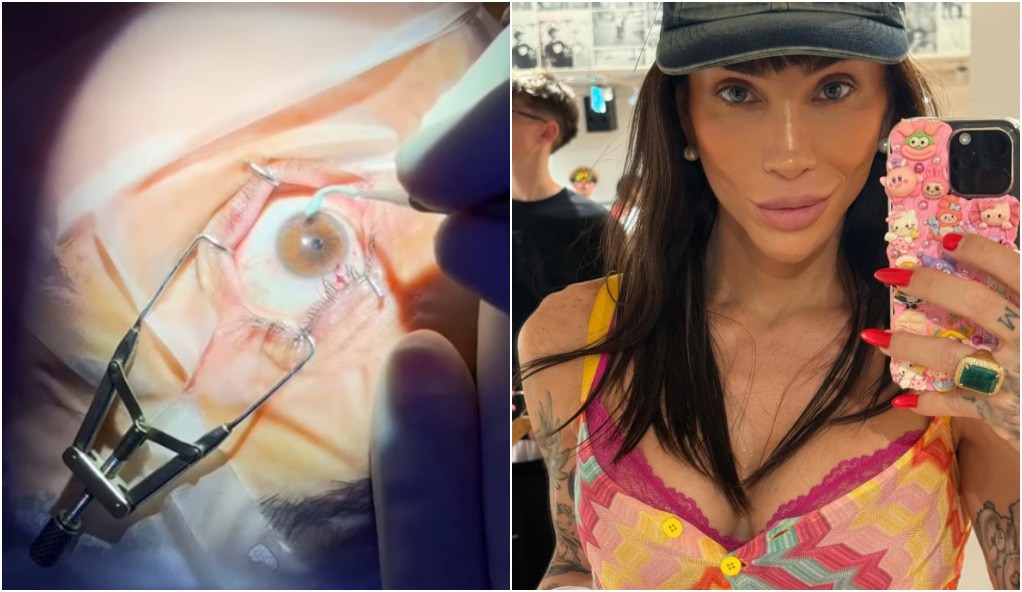 Mudar a cor dos olhos como Maya Massafera é sonho estético ou risco à visão?