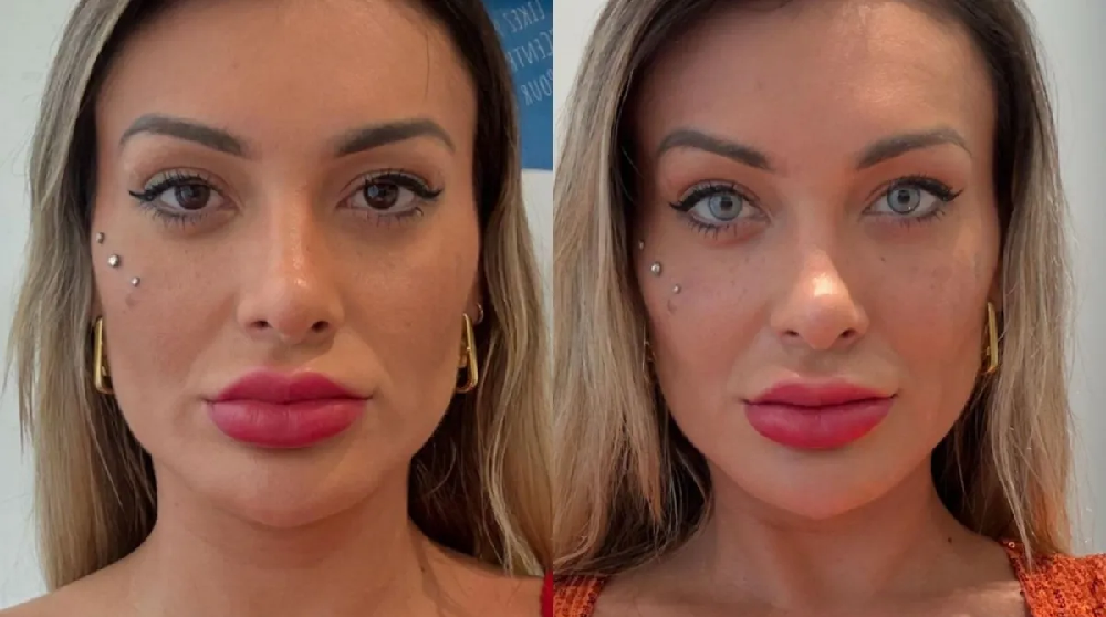 Andressa Urach