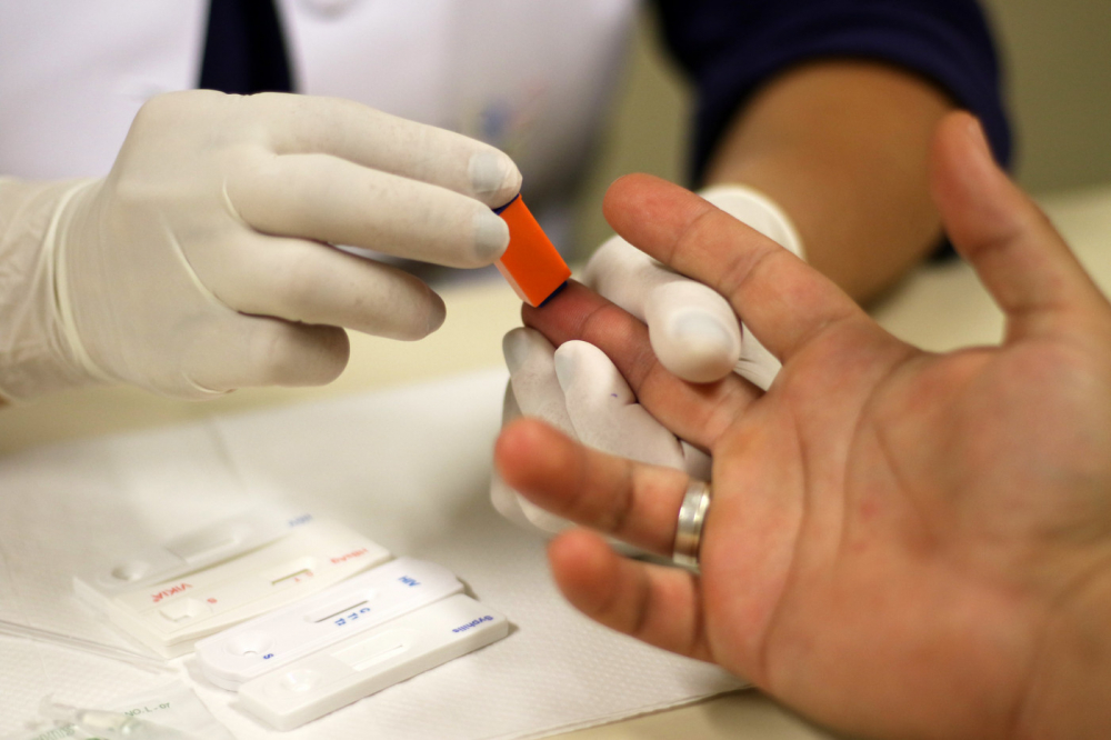 Casos de hepatite A no Brasil aumentam 54,5% em 2024