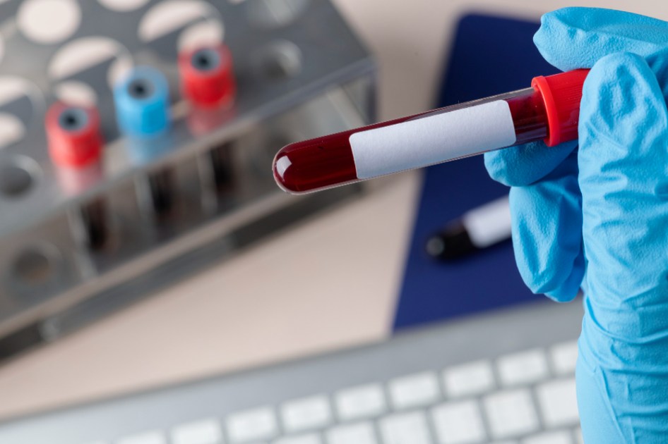 Cirurgião fazendo exame de sangue