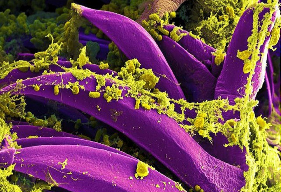 Yersinia pestis é um cocobacilo em forma de bastonete, imóvel e sem esporos, responsável pela peste