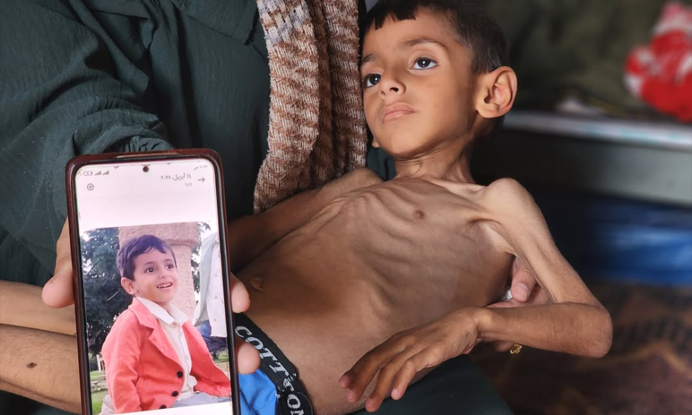 Desnutrição entre crianças em Gaza aumenta devido ao bloqueio israelense