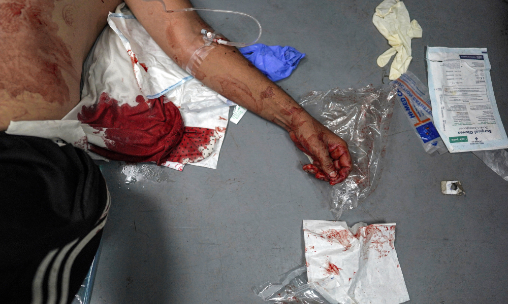 Graphic content / TOPSHOT - The body of a man, who died in the aftermath of bombardment on a displaced persons camp, lies at a trauma ward at the Aqsa Martyrs Hospital in Deir el-Balah in the central Gaza Strip on May 11, 2024 amid the ongoing conflict in the Palestinian territory between Israel and Hamas. (Photo by AFP)