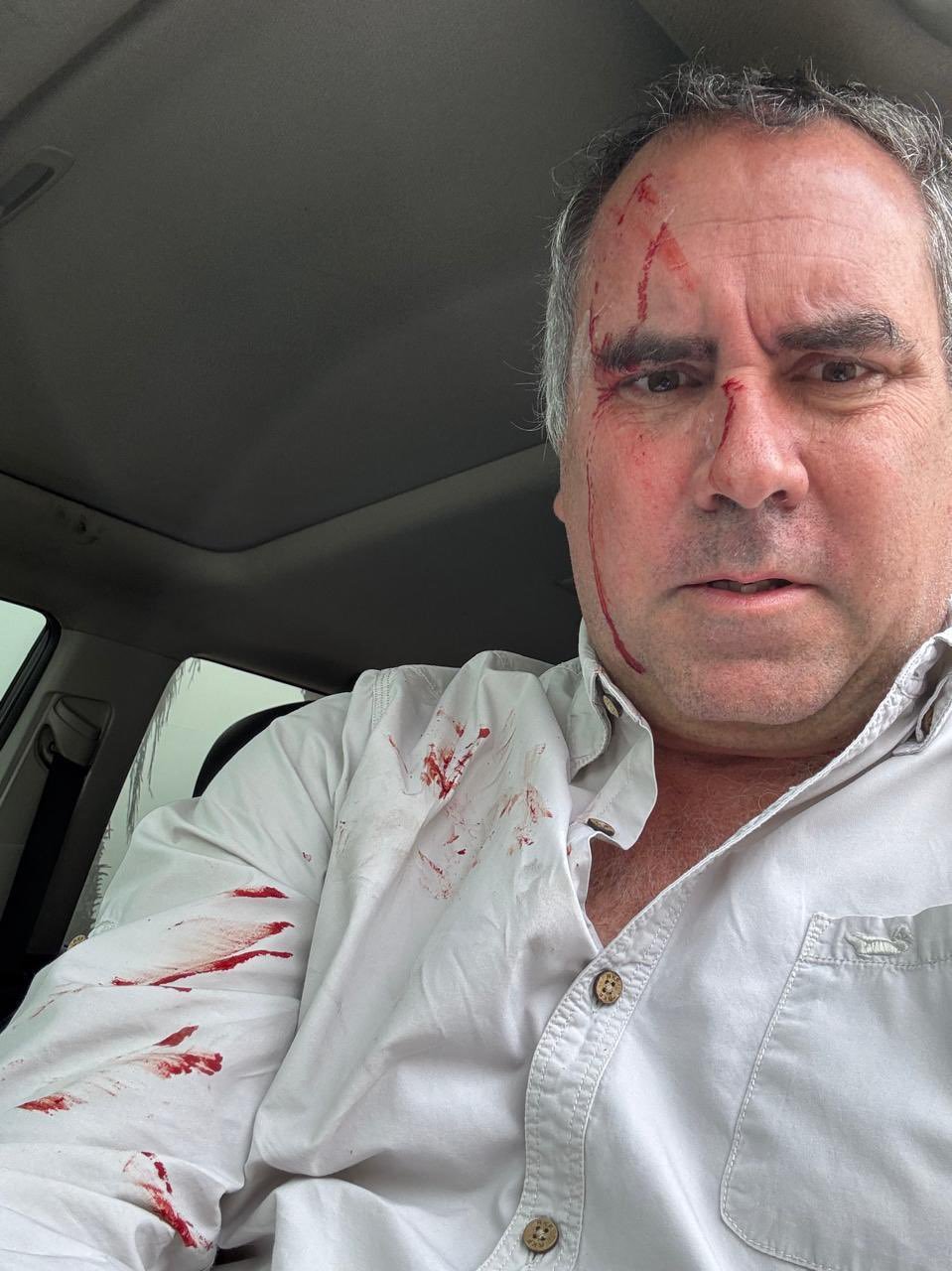 Carro de pré-candidato a presidente do Peru é alvo de tiros