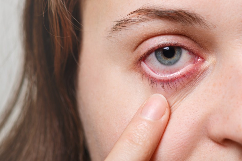 Mulher aponta para um dos olhos