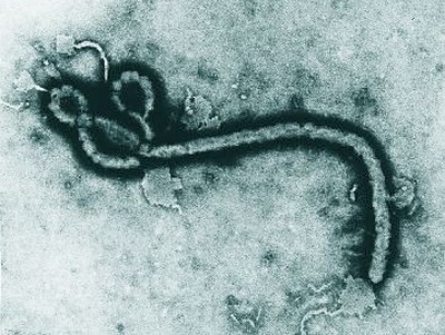 Caso suspeito de Ebola é investigado no RS