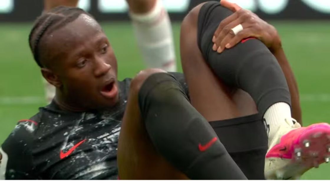 Koné, jogador canadense, se impressiona com perna quebrada
