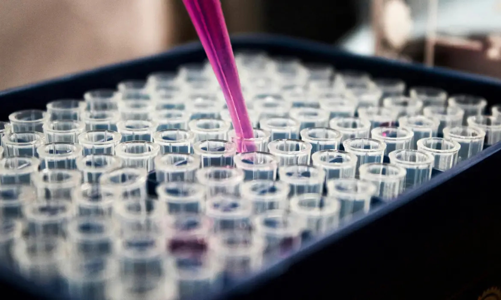 Um simples exame de sangue pode revelar doenças silenciosas