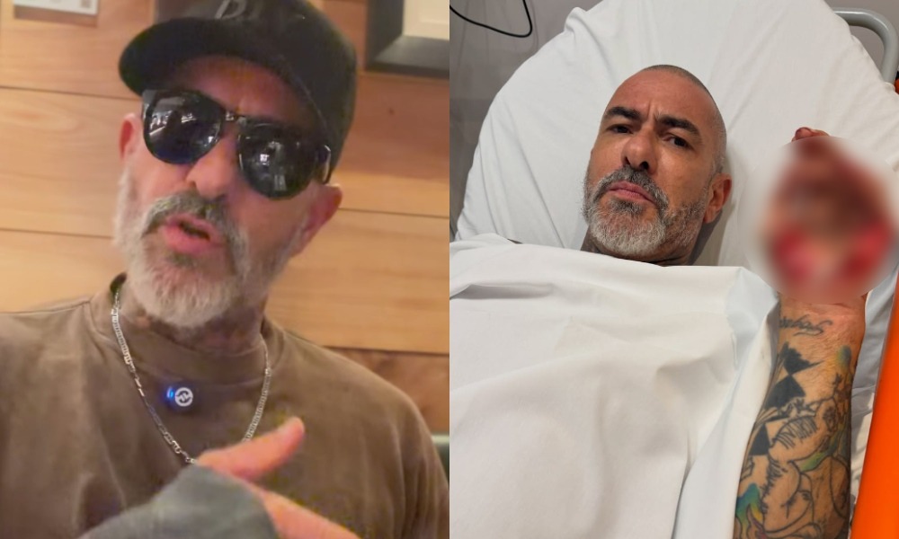 Fogaça revela que sofreu acidente de moto em maio e teve aliança furtada em hospital