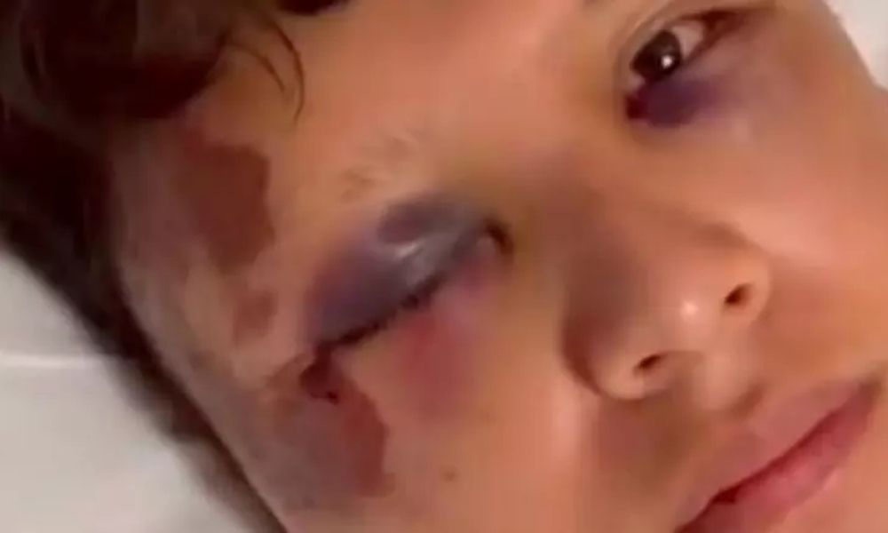 Turista mexicano é hospitalizado após sofrer ataque com garrafa em Copacabana